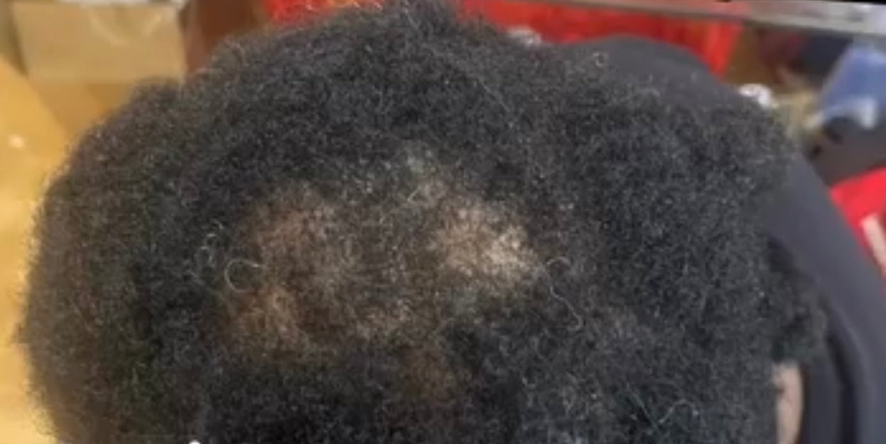 The Hair Revival Ultimate Growth Bundle (5-Piece Set)